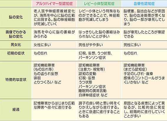 認知症と老化はちがう!