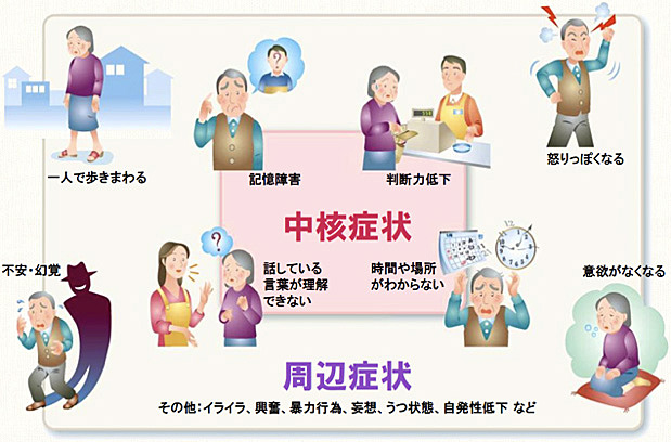 アルツハイマー型認知症