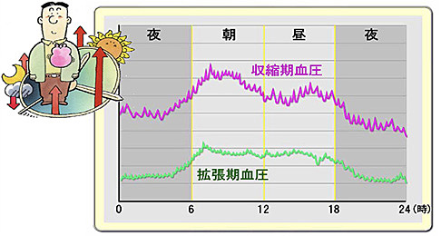 1日の間でも血圧は変化します