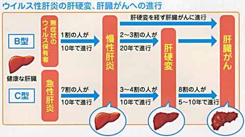 ① ウィルス性肝炎(A型、B型、C型、E型肝炎、EBウイルス)