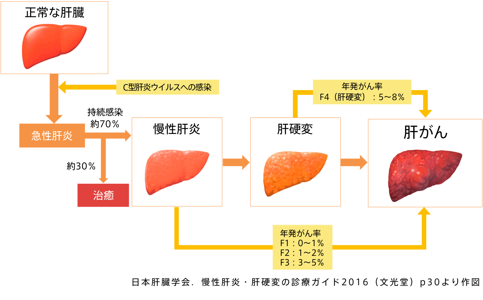 【C型肝炎ウイルス】