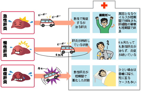 【急性肝炎・劇症肝炎の経過】