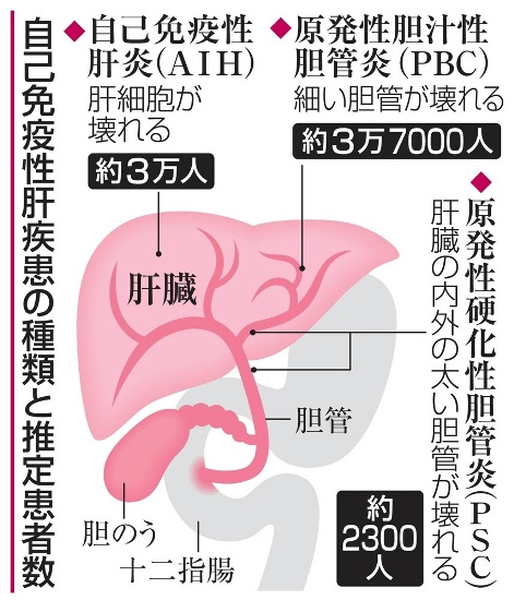 ④ そのほか
