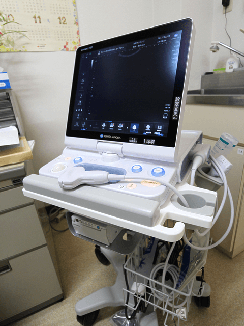エコー検査機器